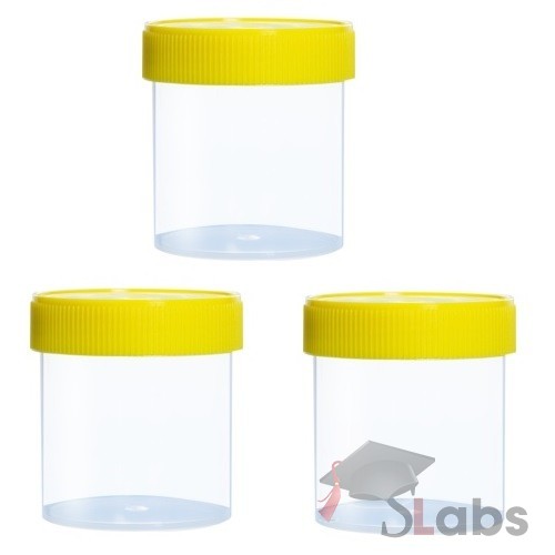 Urine Culture Bottle