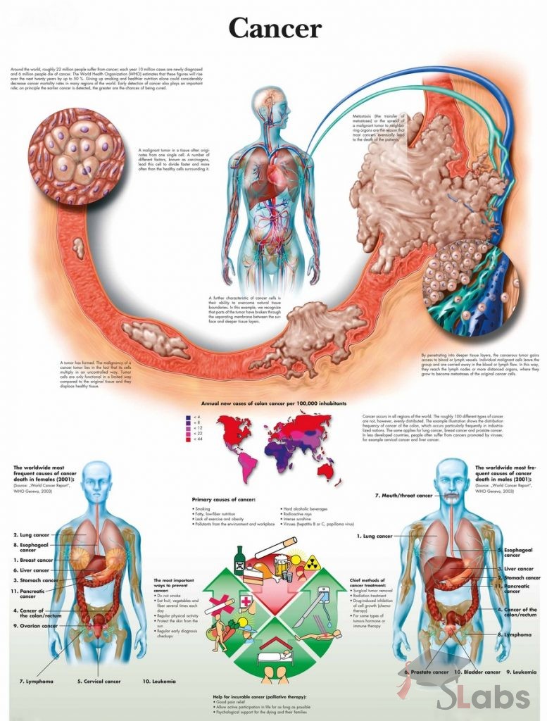 Human Cancer - Scholars Labs